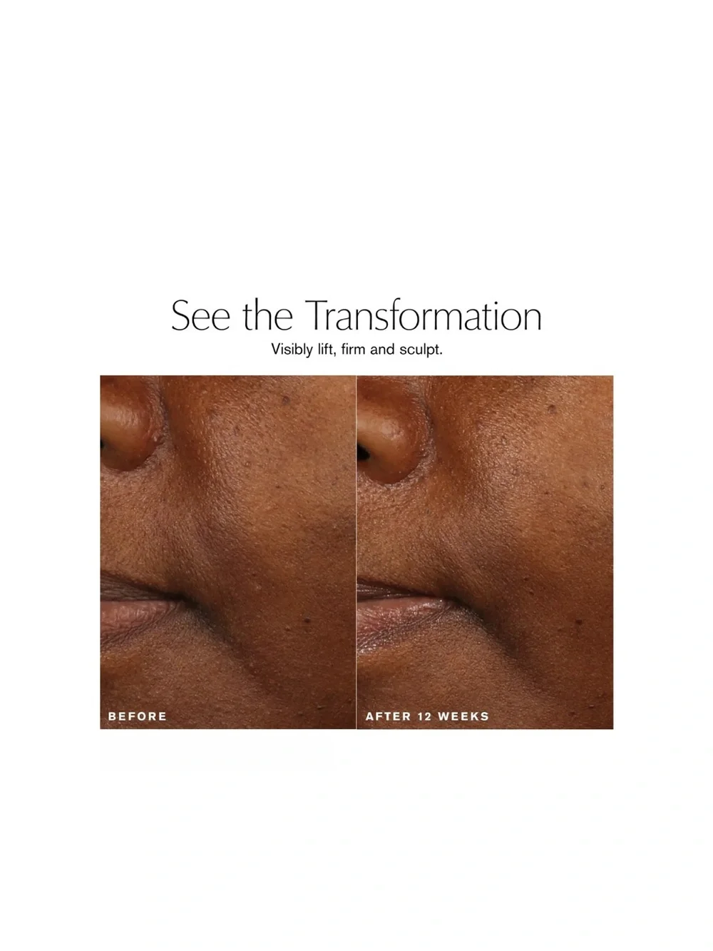 Estee Lauder 5d facelift
